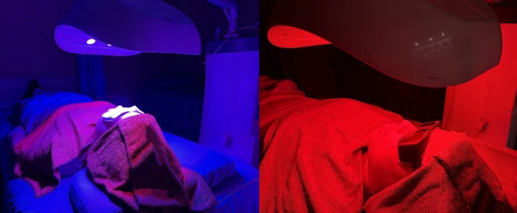 战“痘”失败N+1次，不如试试中西医结合！