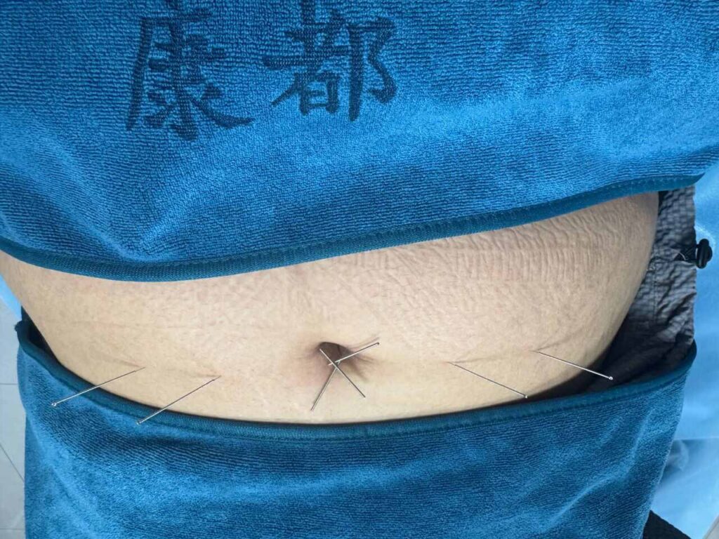 中医减重 | 中医属于“邪修”减重？不节食不吃药