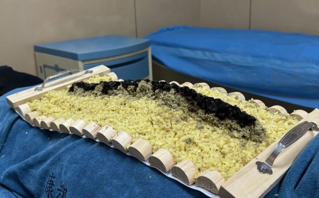 【火龙灸】关节疼痛、胃寒、痛经、气血虚，“火龙”统统为你一扫而光