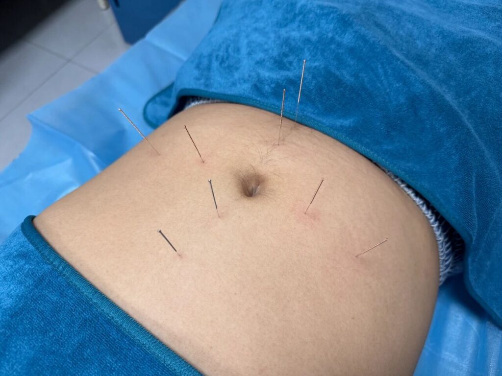 中医减重 | 中医属于“邪修”减重？不节食不吃药