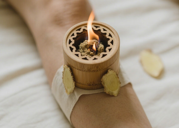 【火龙灸】关节疼痛、胃寒、痛经、气血虚，“火龙”统统为你一扫而光