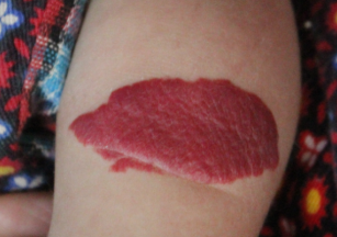 血管瘤并非都能自愈，别盲目等待！