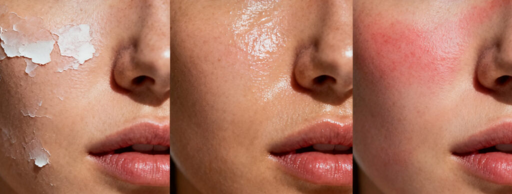 立冬前后用面霜，你真的用对了吗？皮肤科医生独家揭秘“黄金时间”